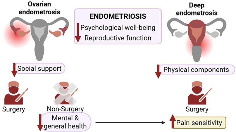 Diagram illustrating two types of endometriosis. On the left, ovarian endometriosis affects psychological well-being and reproductive function, leading to decreased social support and non-surgical treatment affecting mental health. Surgery is also shown as an option. On the right, deep endometriosis impacts physical components, with surgery suggested and increased pain sensitivity highlighted. Both types show organs affected in red.