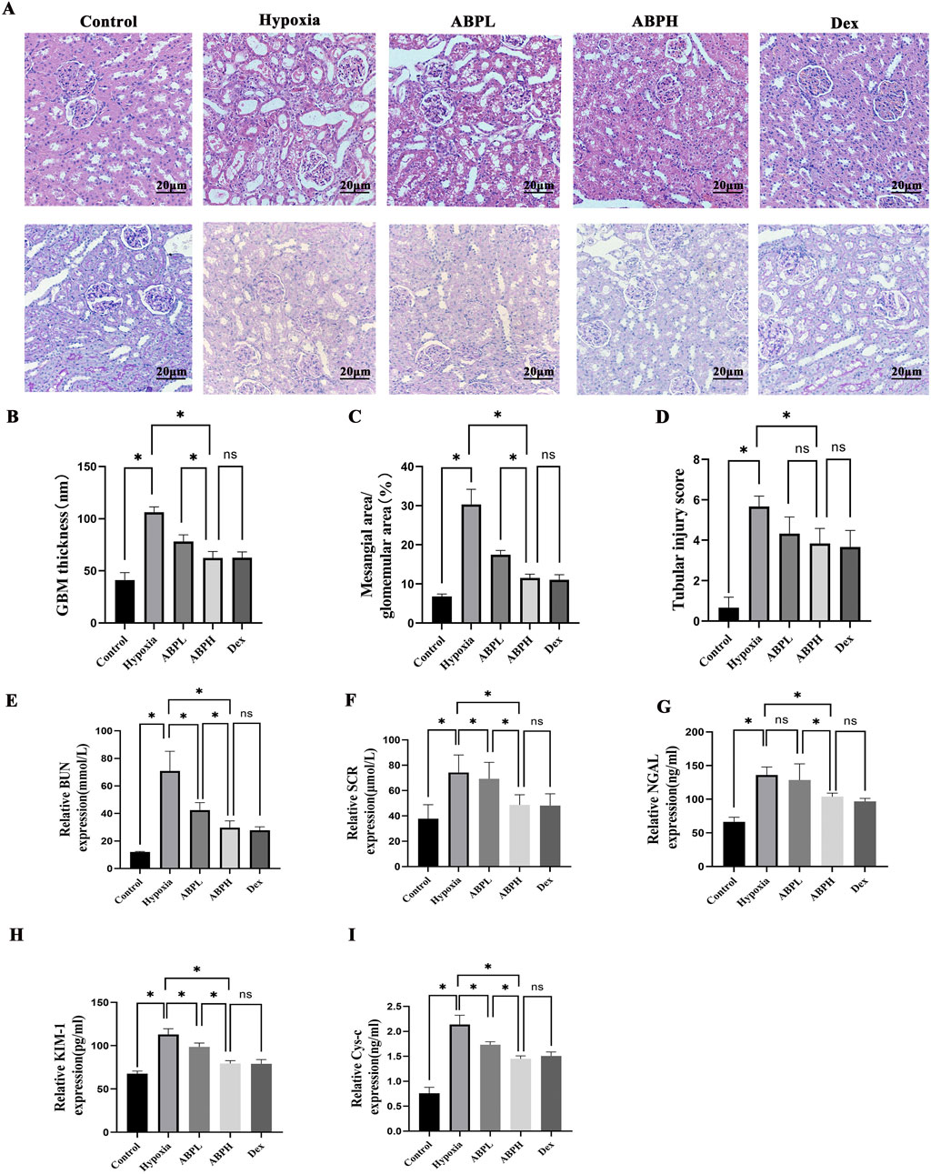 Microscopic images and bar graphs analyze renal tissue and kidney function. Panel A displays renal histology under different conditions: Control, Hypoxia, ABPL, ABPH, and Dex. Panels B to I present bar graphs measuring GBM thickness, mesangial area, tubular injury score, BUN, SCR, NGAL, KIM-1, and Cys-C expression. Significant differences are marked with asterisks;