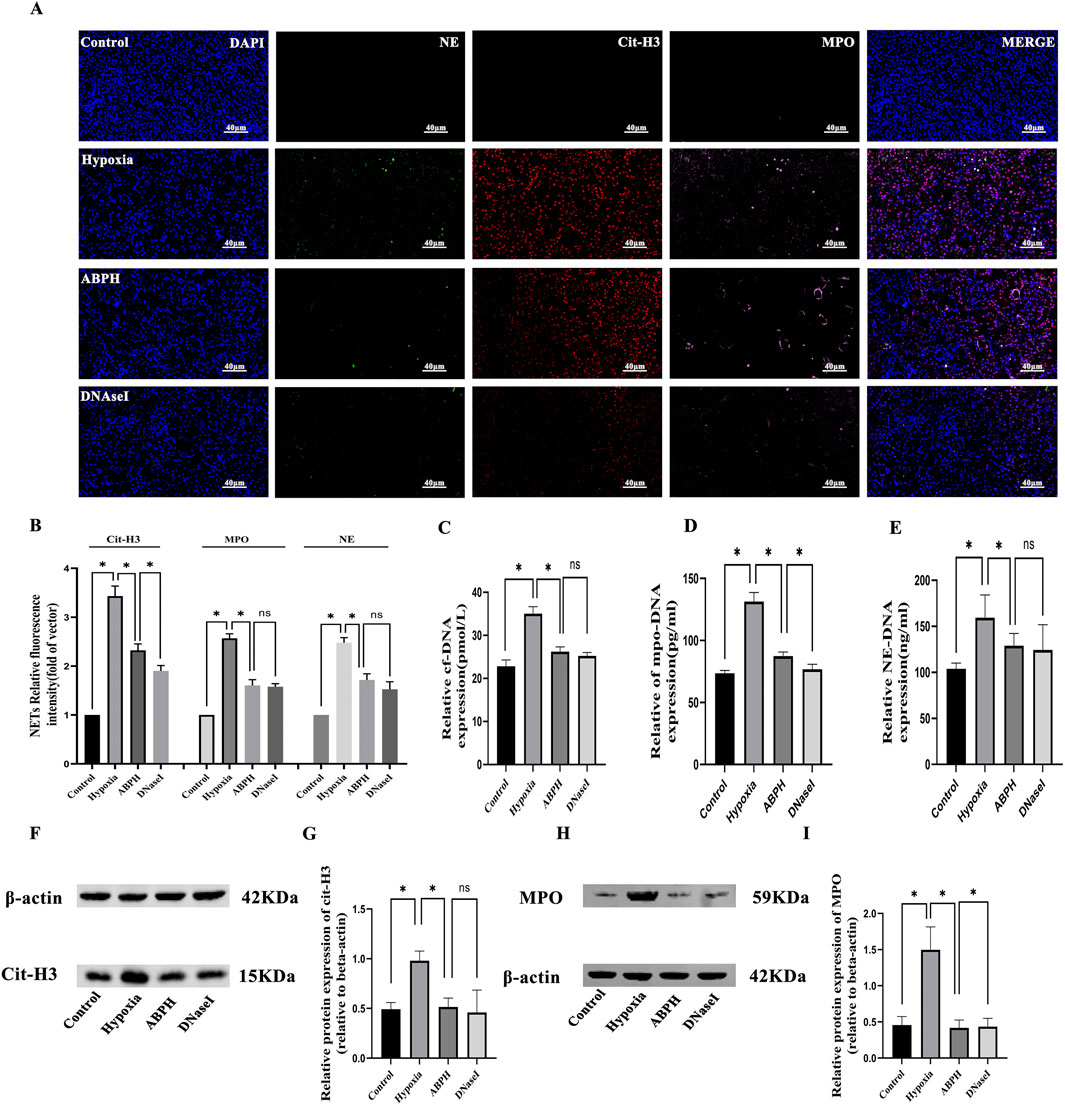 Research image with multiple panels displaying microscope images, charts, and protein expression analyses. Panel A shows fluorescent-stained cells under different conditions: control, hypoxia, ABPH, and DNase I, with labels DAPI, NE, Cit-H3, MPO, and MERGE. Panel B presents a bar graph of relative fluorescence intensity for Cit-H3, MPO, and NE. Panels C to E feature bar graphs showing relative expression levels of cf-DNA, mpo-DNA, and NE-DNA. Panel F presents Western blot images for β-actin and Cit-H3, with relative protein expression displayed in panel G. Panels H and I show Western blot images for MPO and corresponding protein expression levels.
