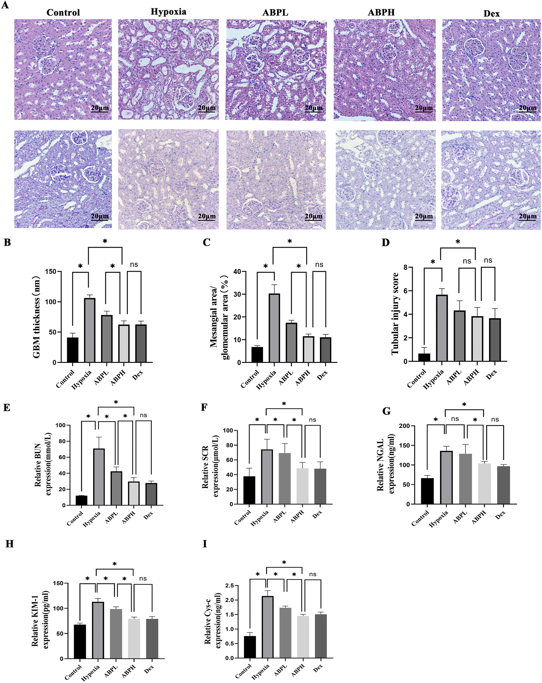 Microscopic images and bar graphs analyze renal tissue and kidney function. Panel A displays renal histology under different conditions: Control, Hypoxia, ABPL, ABPH, and Dex. Panels B to I present bar graphs measuring GBM thickness, mesangial area, tubular injury score, BUN, SCR, NGAL, KIM-1, and Cys-C expression. Significant differences are marked with asterisks; "ns" indicates not significant. Scale bars and units are provided.