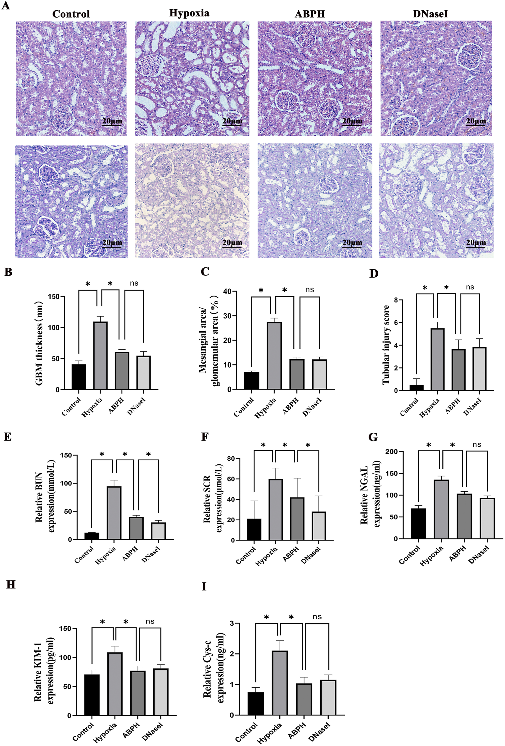 Histological and bar graph data illustrating kidney tissue analyses under different conditions: Control, Hypoxia, ABPH, and DNaseI. Panel A shows histological sections with varying cellular features. Panels B to I present bar graphs comparing measurements such as GBM thickness, mesangial area, tubular injury, and various biomarker expressions. Significant differences noted with asterisks indicate changes in each condition. Each panel is labeled for clarity.