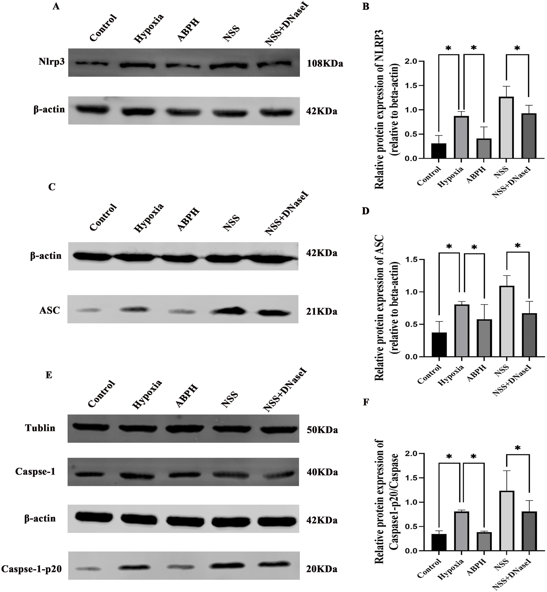 Western blot analysis showing protein expression levels of Nlrp3, ASC, and Caspase-1 across different conditions: Control, Hypoxia, ABPH, NSS, and NSS plus DNase I. Graphs to the right depict relative expression levels of NLRP3, ASC, and Caspase-1 normalized to beta-actin. Statistical significance is indicated with asterisks for certain comparisons.