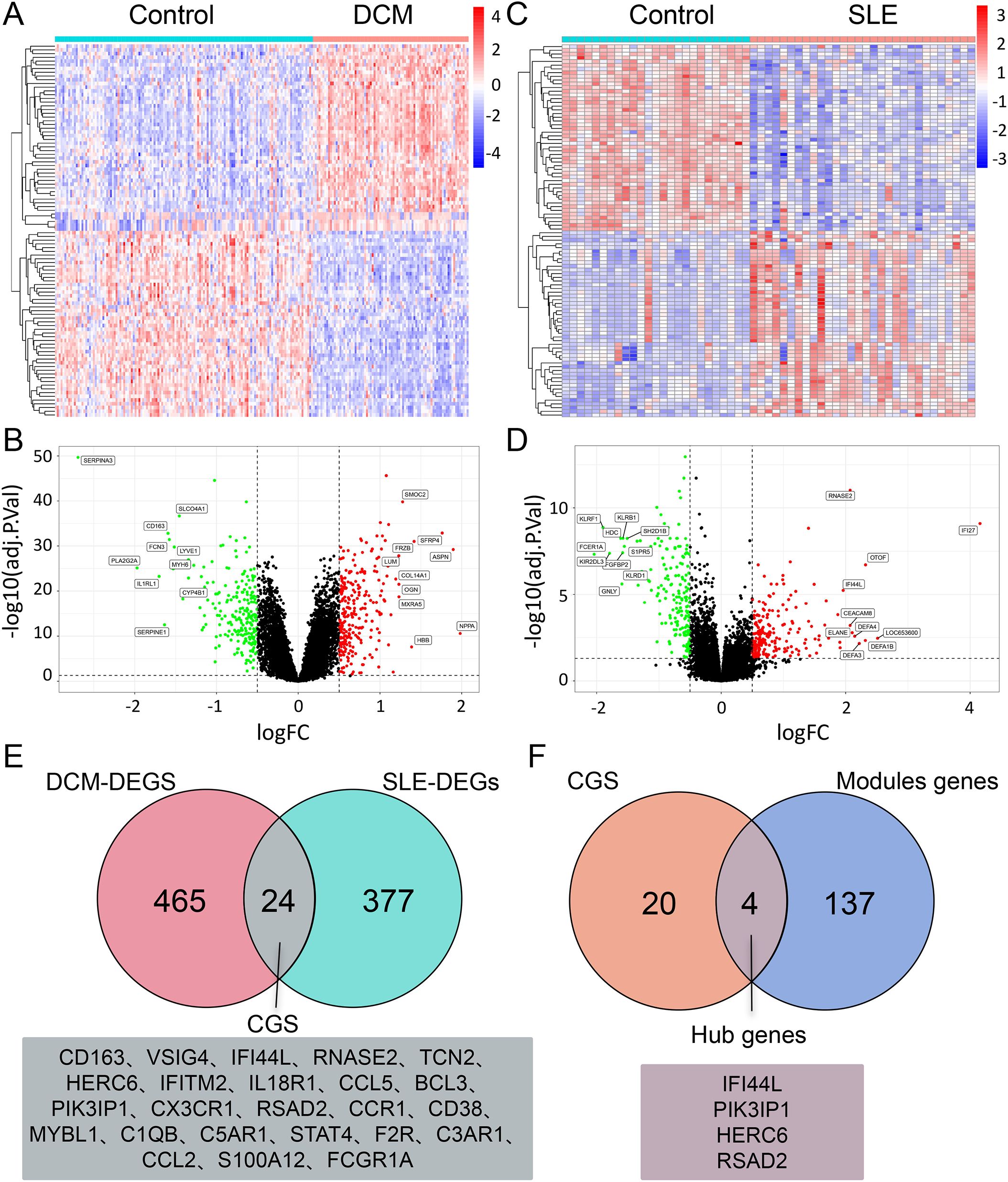 Heatmaps and volcano plots show gene expression for control versus DCM and SLE conditions. Venn diagrams depict overlapping differentially expressed genes (DEGs) for DCM and SLE, and common genes between candidate gene sets (CGS) and module genes, highlighting hub genes.