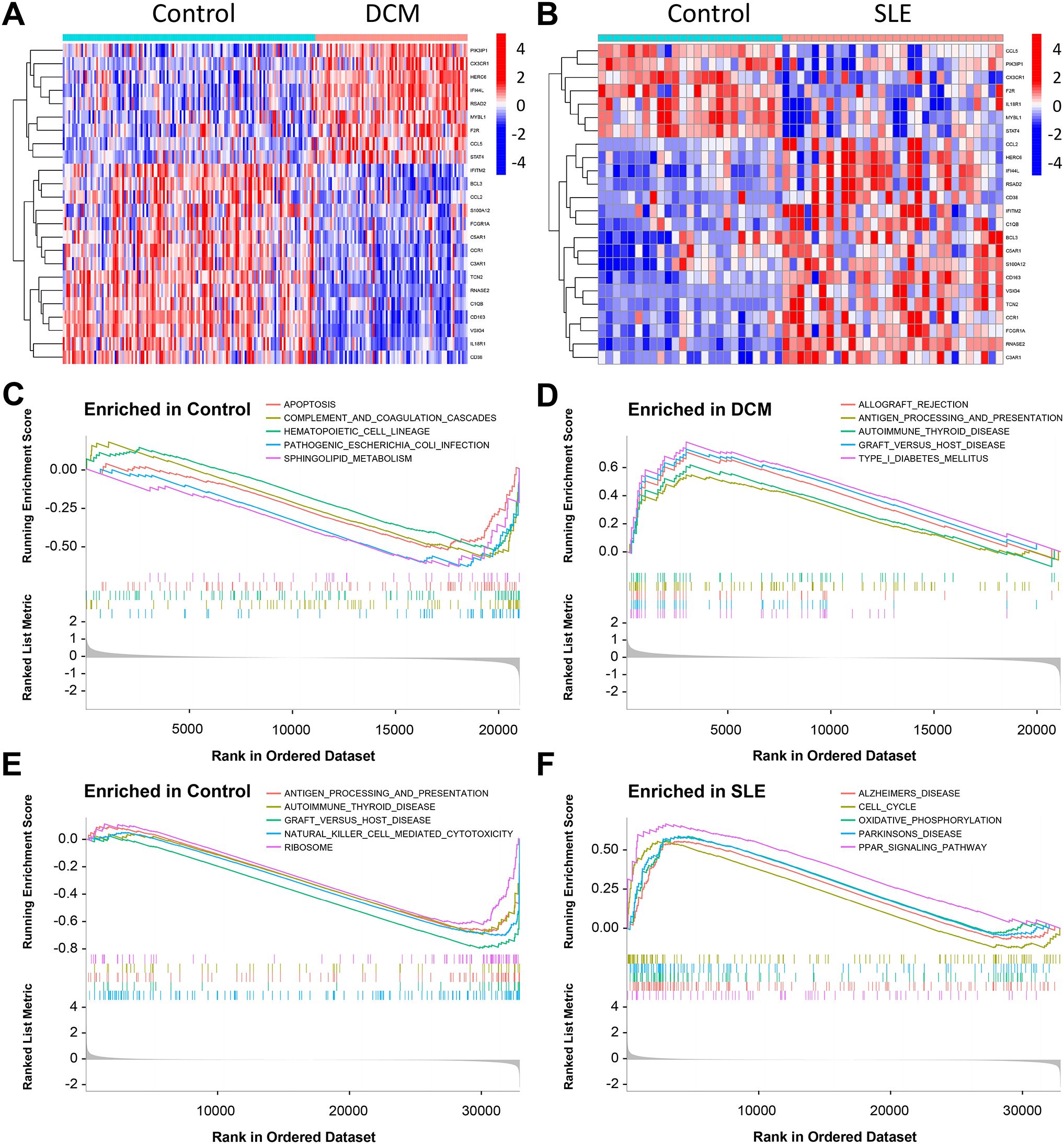 Heatmaps and enrichment plots for gene expression analysis. Panels A and B are heatmaps comparing control with DCM and SLE, respectively, using color scales from blue to red to indicate expression levels. Panels C, D, E, and F present line graphs showing gene set enrichment scores for control, DCM, and SLE conditions, with pathways labeled. The x-axes represent rank in ordered dataset and the y-axes show running enrichment scores.