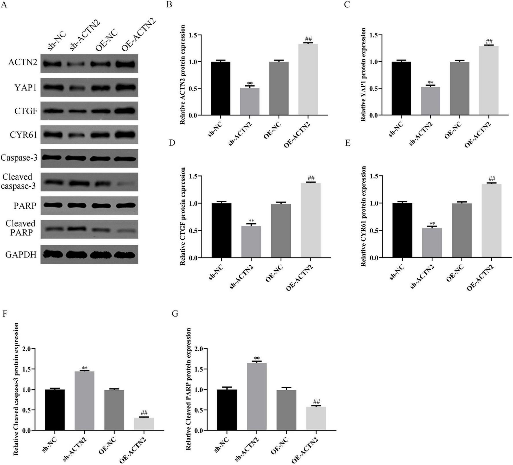 Western blot analysis and bar graphs depicting protein expression levels. Panel A shows protein bands for ACTN2, YAP1, CTGF, CYR61, Caspase-3, Cleaved Caspase-3, PARP, Cleaved PARP, and GAPDH under different conditions: sh-NC, sh-ACTN2, OE-NC, and OE-ACTN2. Panels B to G present bar graphs of relative protein expression for ACTN2, YAP1, CTGF, CYR61, Cleaved Caspase-3, and Cleaved PARP, respectively, with statistical significance indicated by asterisks and hash marks.