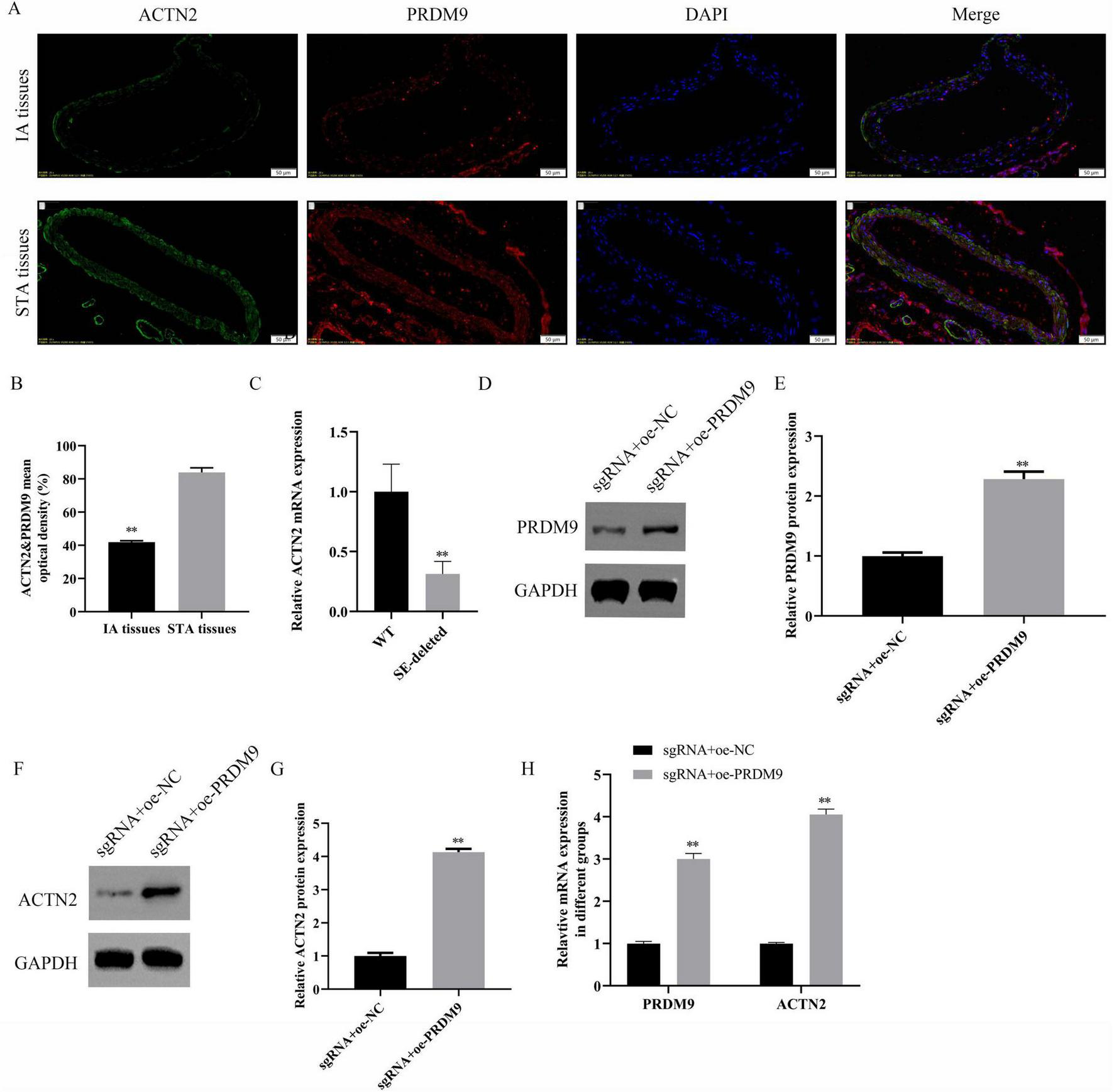 Composite image showing immunofluorescence and Western blot analysis. (A) Fluorescent staining of IA and STA tissues for ACTN2, PRDM9, and DAPI, with merged images. (B) Bar graph of ACTN2 and PRDM9 co-localization in IA vs. STA tissues. (C) Bar graph showing relative ACTN2 mRNA expression in wild type and SE-deleted samples. (D) Western blot comparing PRDM9 and GAPDH expression. (E) Bar graph of relative PRDM9 protein expression in two sample groups. (F) Western blot comparing ACTN2 and GAPDH expression. (G) Bar graph showing relative ACTN2 protein expression. (H) Bar graph showing relative mRNA expression of PRDM9 and ACTN2 in different groups.