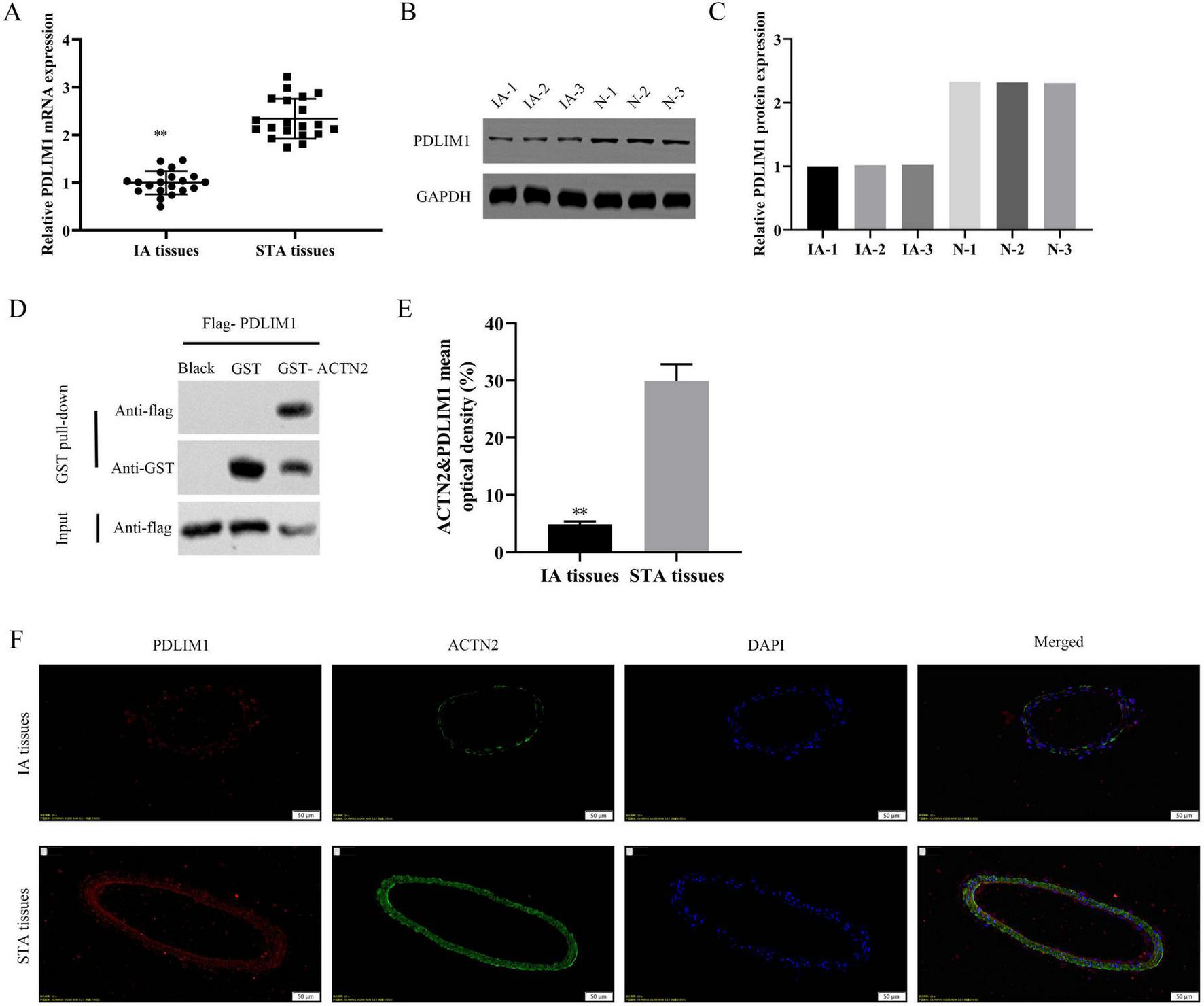Graphs and images show the expression of PDLIM1 and ACTN2 in intracranial aneurysm (IA) and superficial temporal artery (STA) tissues. Panel A displays relative PDLIM1 mRNA expression with lower levels in IA tissues. Panel B shows PDLIM1 and GAPDH protein band intensities. Panel C illustrates relative protein expression with bar graphs. Panel D presents a Western blot analysis indicating protein interactions. Panel E compares ACTN2 and PDLIM1 optical density between IA and STA tissues. Panel F contains immunofluorescence images showing PDLIM1, ACTN2, DAPI-stained nuclei, and merged views for both tissue types.