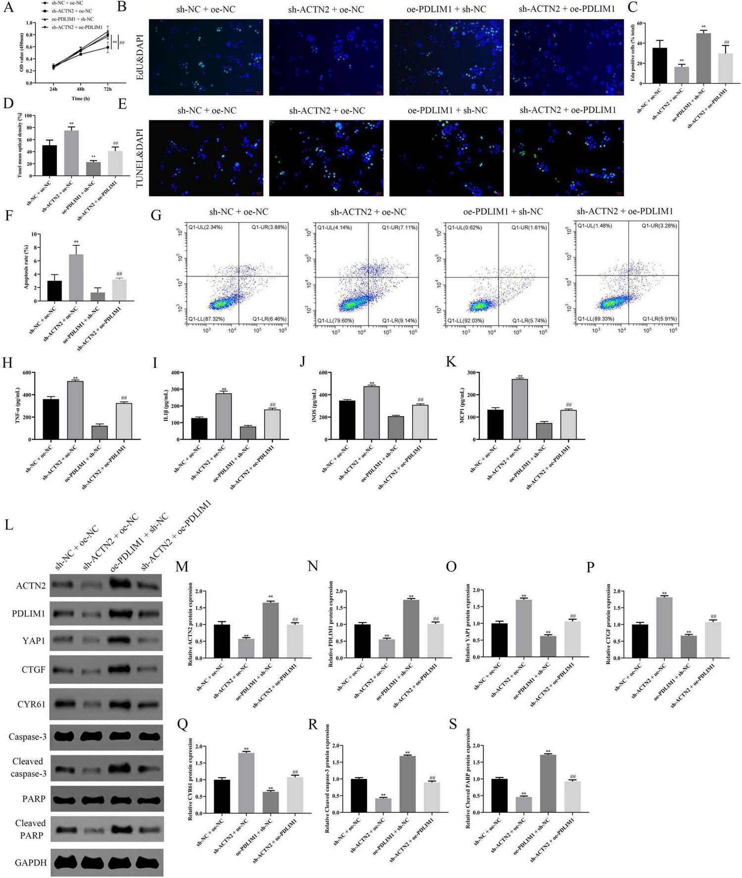 A series of scientific panels depicting experimental results involving various genetic conditions. Panel A shows a line graph comparing cell proliferation over time. Panels B and E contain fluorescence microscopy images of cells stained with DAPI, highlighting differences in expression between different experimental groups. Panels C, D, F, H, I, J, and K show bar graphs representing quantitative measurements of various cellular parameters. Panel G displays flow cytometry plots for apoptosis analysis. Panel L presents Western blot images for protein expression analysis, with panels M to S showing corresponding bar graphs for quantitative expression levels.