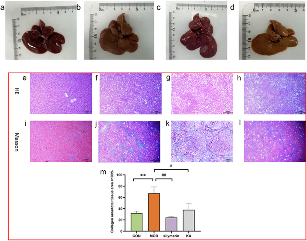 Images of liver samples labeled a to d, with rulers for scale. Sections e to h show H&E stained liver tissue under a microscope, while i to l display Masson’s Trichrome stained liver tissue. The bar chart labeled m compares collagen area percentages among different groups, indicating significant differences.