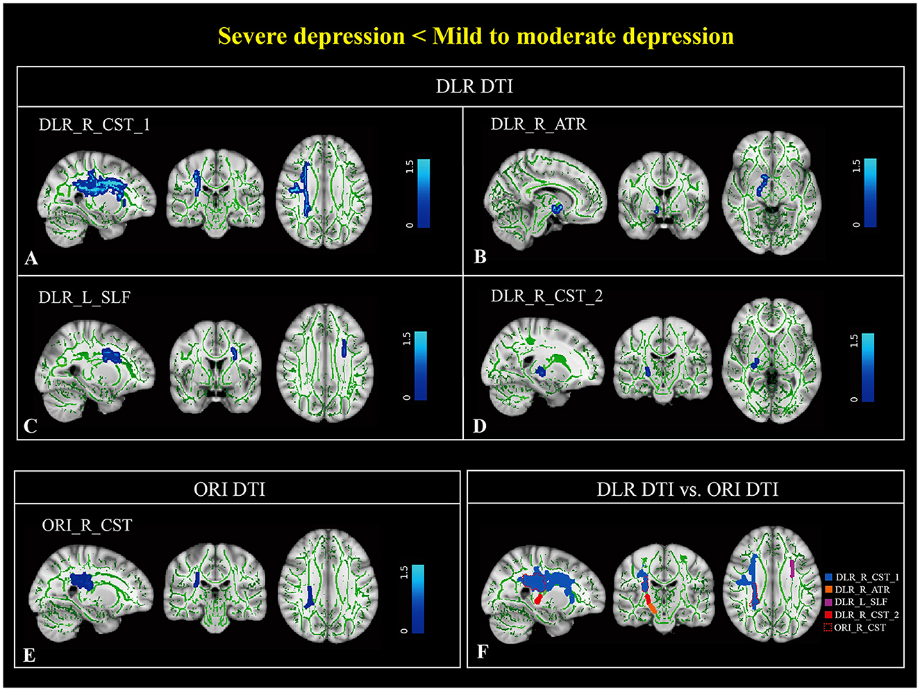 Brain imaging scans in the different groups of patients, labeled A to F. Different areas are highlighted in blue or other colors. Each row and column indicated specific brain regions with a color scale from zero to one point five, showing intensity differences.
