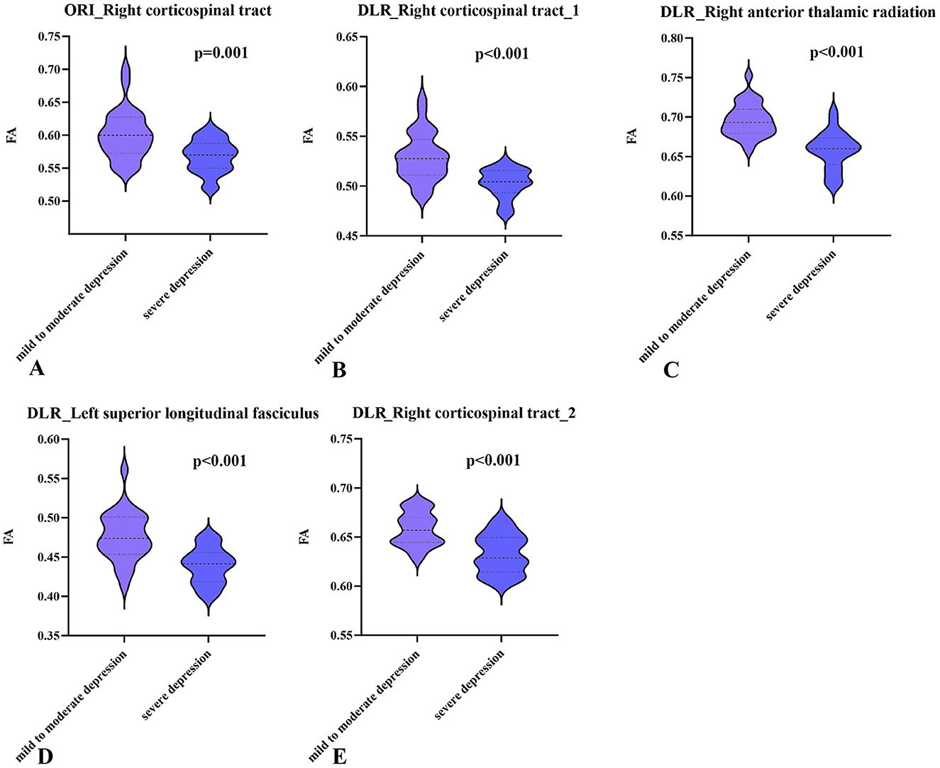 Five violin plots compare fractional anisotropy (FA) values between mild to moderate and severe depression across different brain structures. Plots A (ORI Right corticospinal tract), B (DLR Right corticospinal tract 1), C (DLR Right anterior thalamic radiation), D (DLR Left superior longitudinal fasciculus), and E (DLR Right corticospinal tract 2) all show p-values indicating significant differences (p=0.001 or p < 0.001).