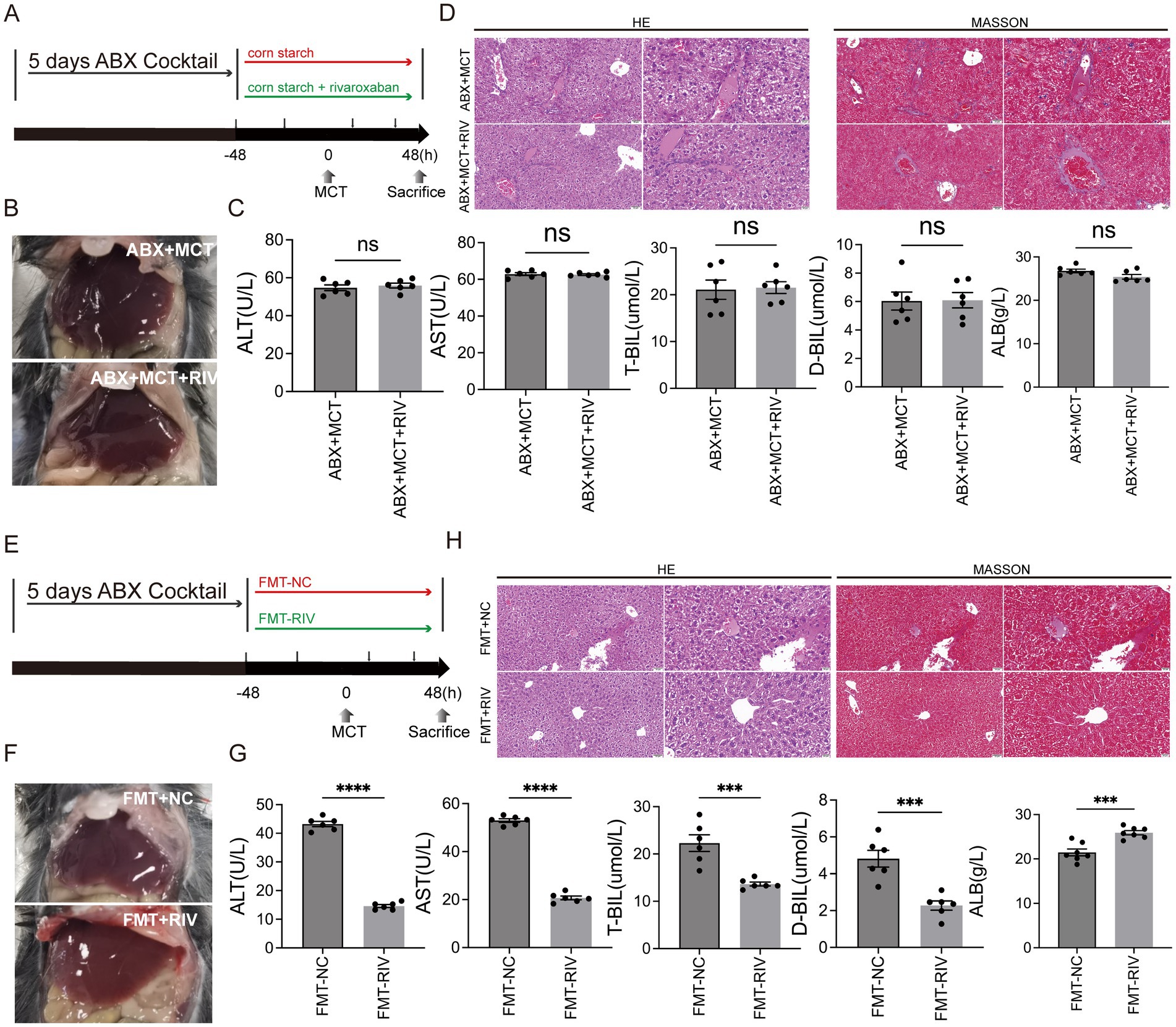 Research study illustration with multiple panels showing effects of treatments on liver condition. Panels A and E depict study timelines with ABX cocktail treatments. Panels B and F display liver images post-treatment, showing differences in coloration and texture. Panels C and G present bar graphs showing liver function test results, including ALT, AST, T-BIL, D-BIL, and ALB levels. Panels D and H contain histological images with HE and Masson staining, illustrating liver tissue structure. Significant differences in treatment groups are indicated with asterisks and
