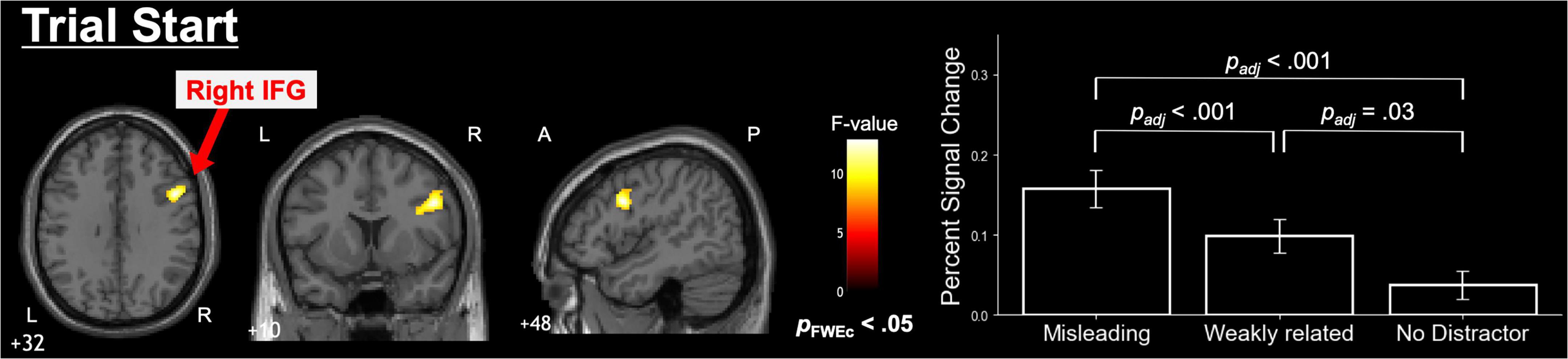 MRI brain scans highlight the right inferior frontal gyrus (IFG) in yellow. A color scale indicates F-values. A bar graph shows percent signal change across conditions: misleading, weakly related, and no distractor. Statistical significance is marked: p < .001 and p = .03.
