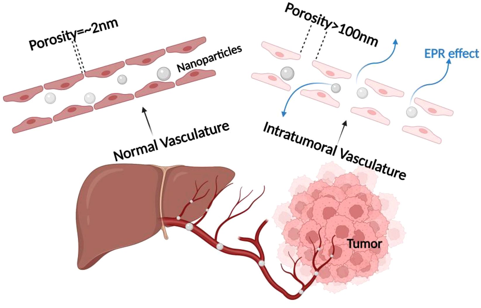 Diagram showing normal and intratumoral vasculature. Normal vasculature has a porosity of approximately two nanometers, limiting nanoparticle movement. Intratumoral vasculature has a porosity greater than one hundred nanometers, allowing enhanced nanoparticle penetration, depicted as the enhanced permeability and retention (EPR) effect. An illustration of a liver and tumor highlights vessel differences.