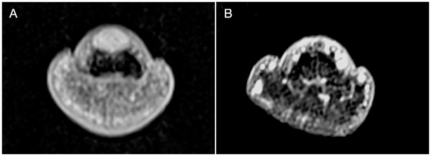MRI scans in a side-by-side comparison. Image A shows a clearer, more defined cross-sectional view of a structure, while Image B appears less detailed and slightly blurred. Both images have a dark background.