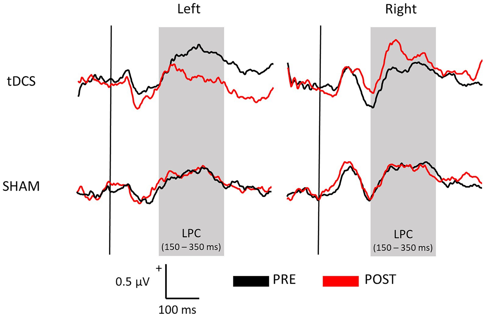 This figure presents average sensory gating waveforms (S1 – S2) recorded across all electrodes, separated into two hemispheric sections: “Left” and “Right.” The top row shows data from the tDCS group, while the bottom row shows data from the SHAM group. In each panel, two lines are plotted: “PRE” (black) representing baseline measurements, and “POST” (red) representing post-stimulation measurements. Grey-shaded areas mark the Late Positive Complex (LPC) time window between 150 and 350 milliseconds. A reference marker below indicates 0.5 microvolts on the vertical axis and 100 milliseconds on the horizontal axis.