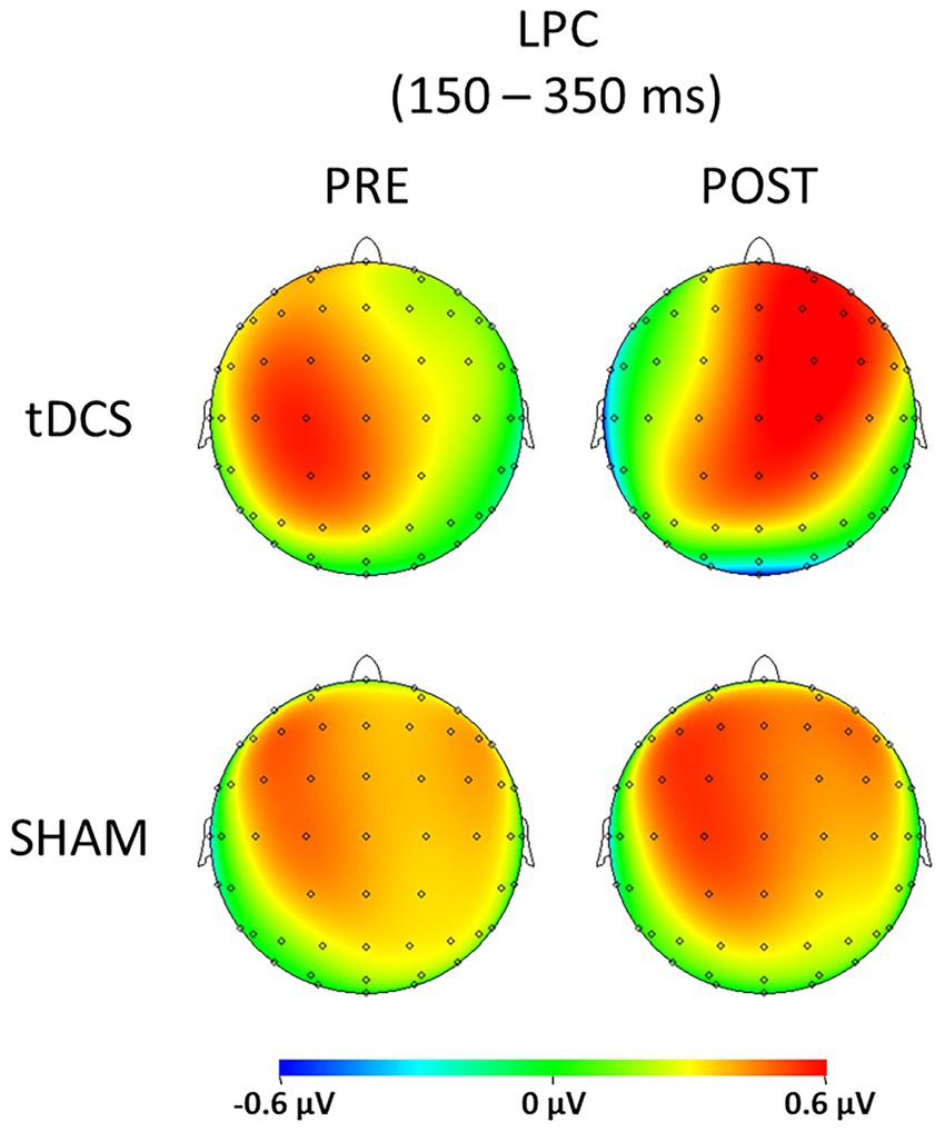 Four circular heatmaps represent sensory gating (S1 – S2) by depicting brain activity during the LPC window (150–350 ms). The top row shows the tDCS condition with “PRE” and “POST” maps, while the bottom row shows the SHAM condition. Colors range from blue to red, indicating voltage values from -0.6 to 0.6 µV.