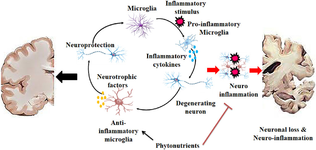 Diagram illustrating the cycle of neuroinflammation and neuroprotection. Microglia react to inflammatory stimuli, turning pro-inflammatory and releasing cytokines, leading to neuroinflammation and neuronal degeneration. Conversely, anti-inflammatory microglia release neurotrophic factors for neuroprotection. Phytonutrients can inhibit neuroinflammation, promoting brain health. Images of brain slices depict neurodegeneration stages.