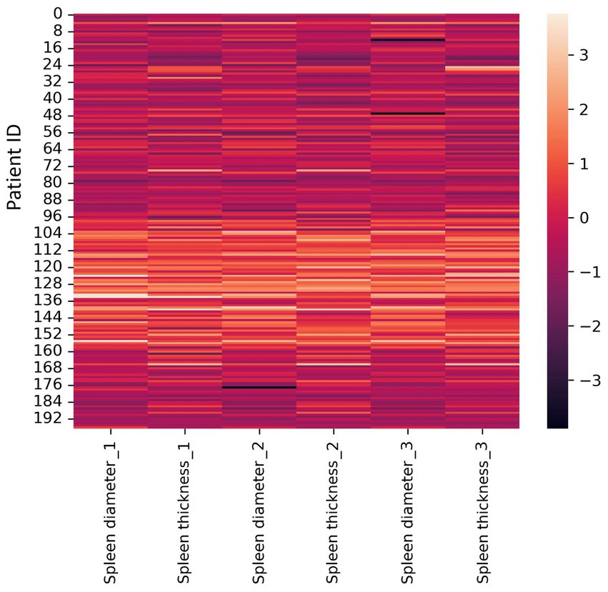 Heatmap displaying spleen measurements, with vertical axis ranging from 0 to 192 and labeled columns for spleen diameter and thickness at radiologist 1 to 3. Color gradients indicate values from -3 to 3, with darker shades representing lower values and lighter shades higher values.