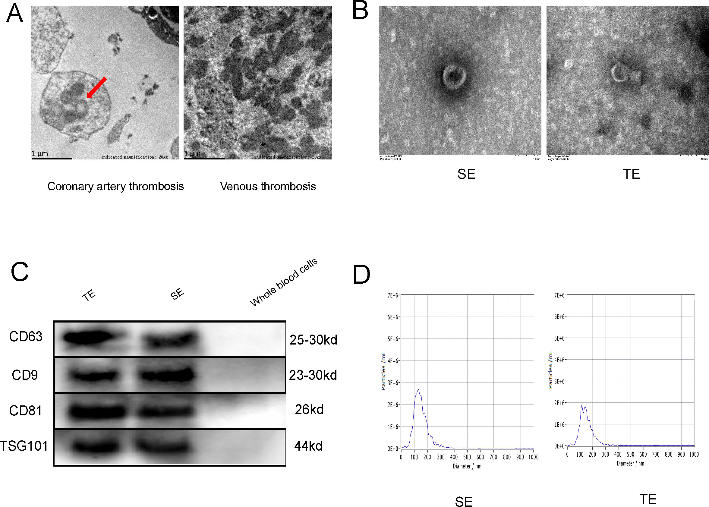 Panel A: Electron microscope images showing coronary artery thrombosis with a red arrow and venous thrombosis. Panel B: Microscopic images labeled SE and TE. Panel C: Protein expression analysis showing bands for CD63, CD9, CD81, and TSG101 in TE, SE, and whole blood cells, with molecular weights. Panel D: Graphs display particle size distribution for SE and TE, with peaks around 100-200 nm.
