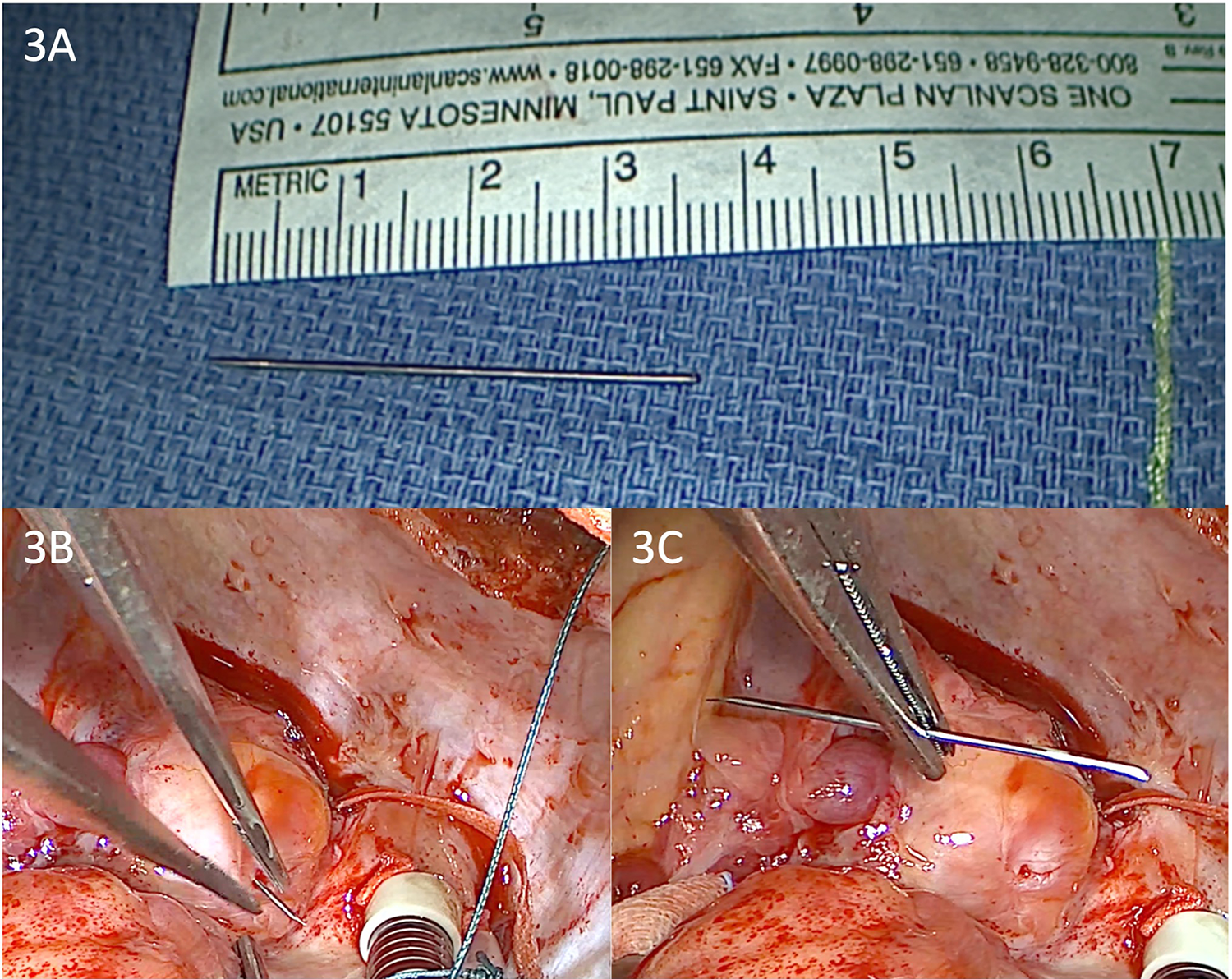 Panel 3A shows a surgical needle on a blue textile with a ruler nearby for scale. Panel 3B depicts a surgical scene with forceps holding tissue near a cylindrical tool. Panel 3C displays forceps guiding a needle through tissue, indicating a surgical procedure.