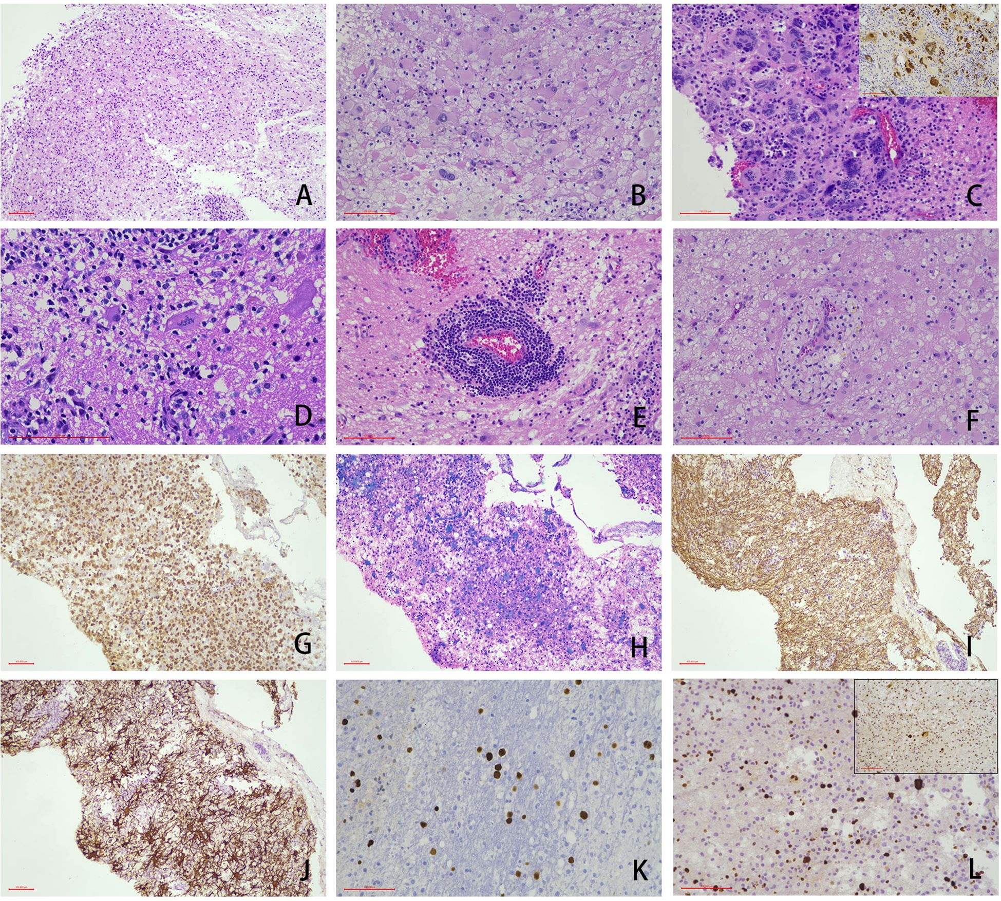 A series of twelve microscopy images labeled A to L, showing various stained tissue samples. Each image features different cell structures, colors, and staining patterns, highlighting changes in the tissues. Insets in images C and L show additional staining detail.