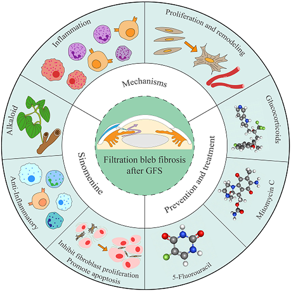 Circular infographic illustrating mechanisms and prevention methods for filtration bleb fibrosis after GFS. Sections include inflammation, proliferation, remodeling, alkaloid, anti-inflammatory, sinomenine, and treatments like glucocorticoids, mitomycin C, and 5-fluorouracil. Central image shows surgical hands around an eye.