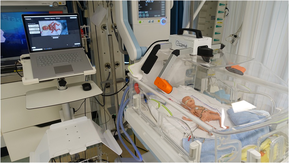 A neonatal intensive care unit setup with a premature infant in an incubator. The infant is monitored with medical equipment visible, including tubes and sensors. A laptop nearby shows an image of the infant, presumably for remote monitoring. The environment appears sterile and medical.