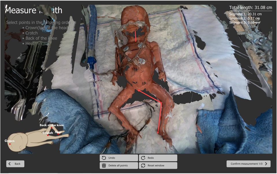 3D scan of a medical context showing a doll-like figure on a textured surface. Red lines indicate measurement segments from head to toe. Instructions on selecting points for measurement appear on the left. Total length is 31.08 cm.