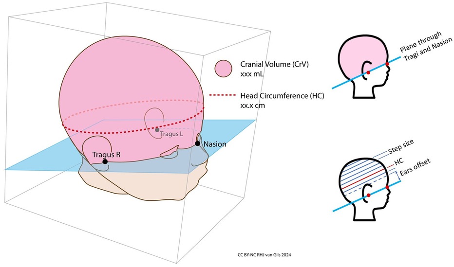 Illustration of head measurements showing cranial volume (CrV) and head circumference (HC). A 3D head model displays the nasion and tragus points. Side diagrams depict measurement planes through the tragi and nasion, with labels for step size, HC, and ears offset.