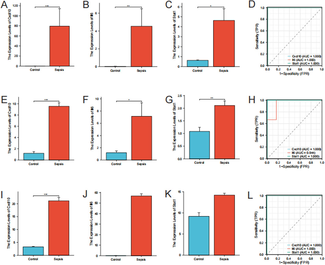 Graphs show expression levels of Cxcl10, Il6, and Stat1 in control and sepsis conditions, with sepsis showing higher expression across all. ROC curves depict high AUC values indicating strong predictive models for these markers.