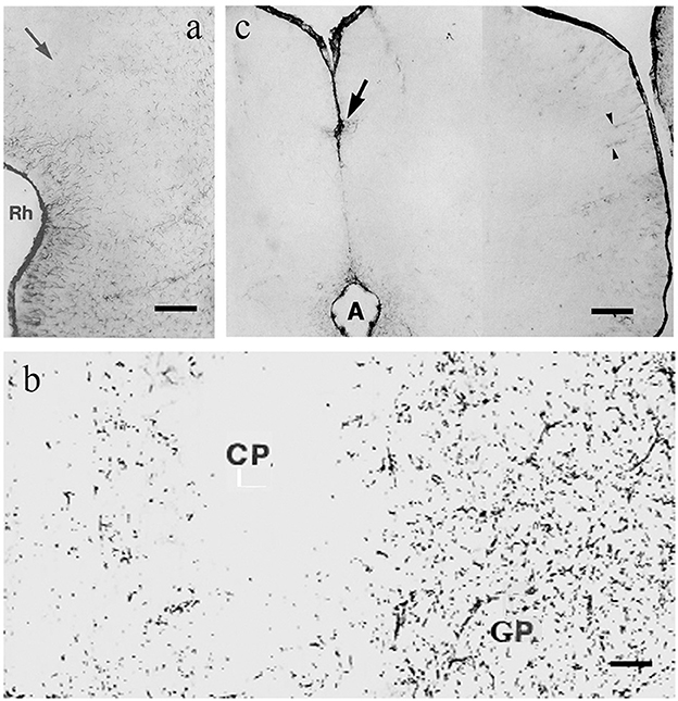 Microscopic images labeled a, b, and c showing thin, dark, branching structures on a pale background. Image a highlights the region labeled “Rh” with an arrow. Image b shows scattered dark spots labeled “CP” and “GP.” Image c features a central dark line with an arrow, and labels “A” and arrowheads. Scale bars are visible in all images.