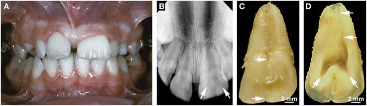 ground section of tooth pdf