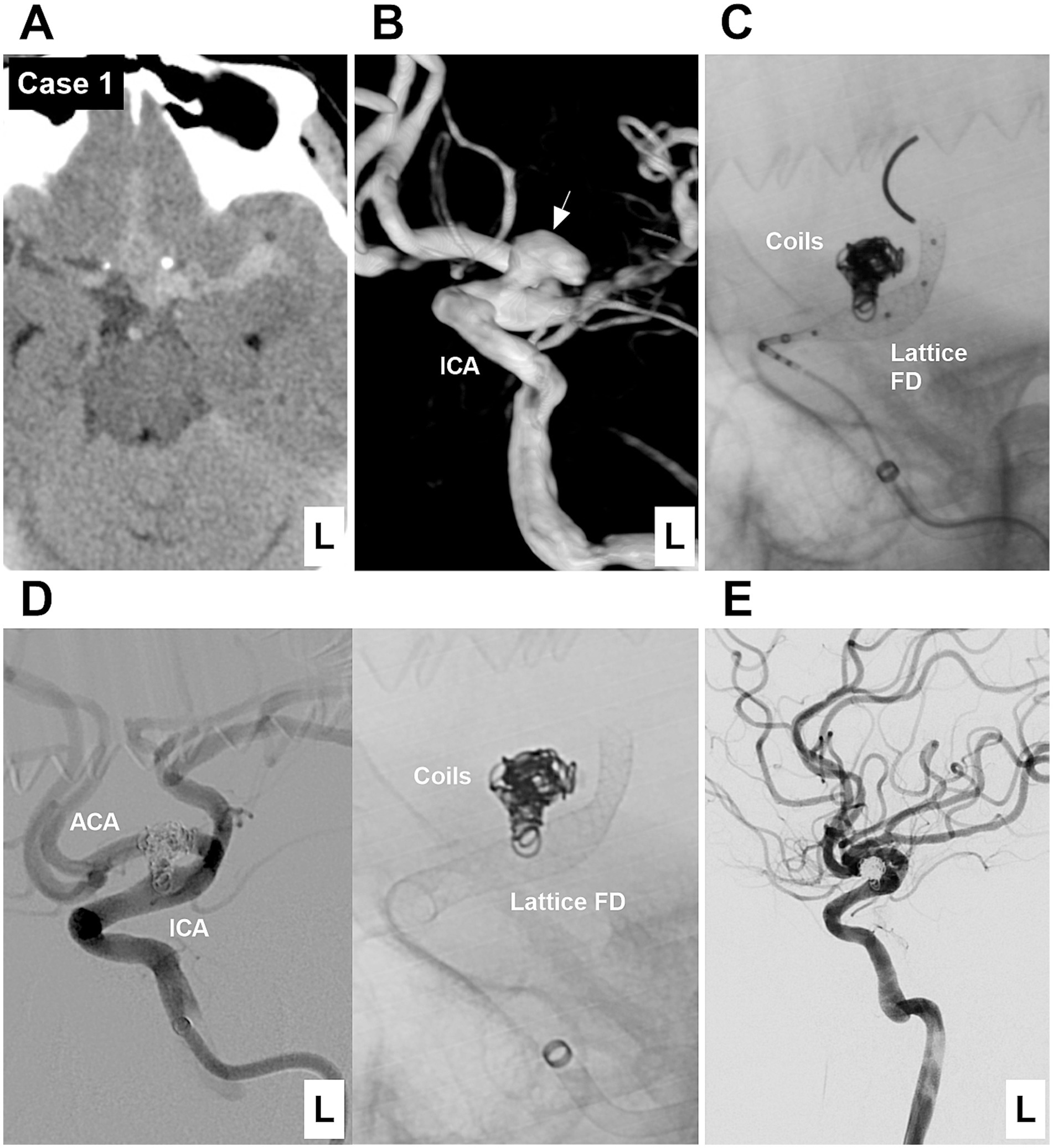 A series of medical imaging scans labeled A to E. A: CT scan showing brain anatomy with label