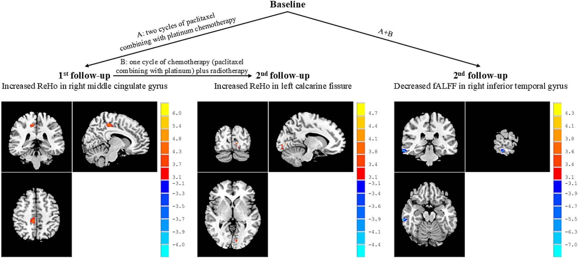 Brain imaging results show changes in ReHo and fALFF values over follow-ups. The first follow-up shows increased ReHo in the right middle cingulate gyrus. The second follow-up shows increased ReHo in the left calcarine fissure and decreased fALFF in the right inferior temporal gyrus. Color scales indicate the magnitude of changes.