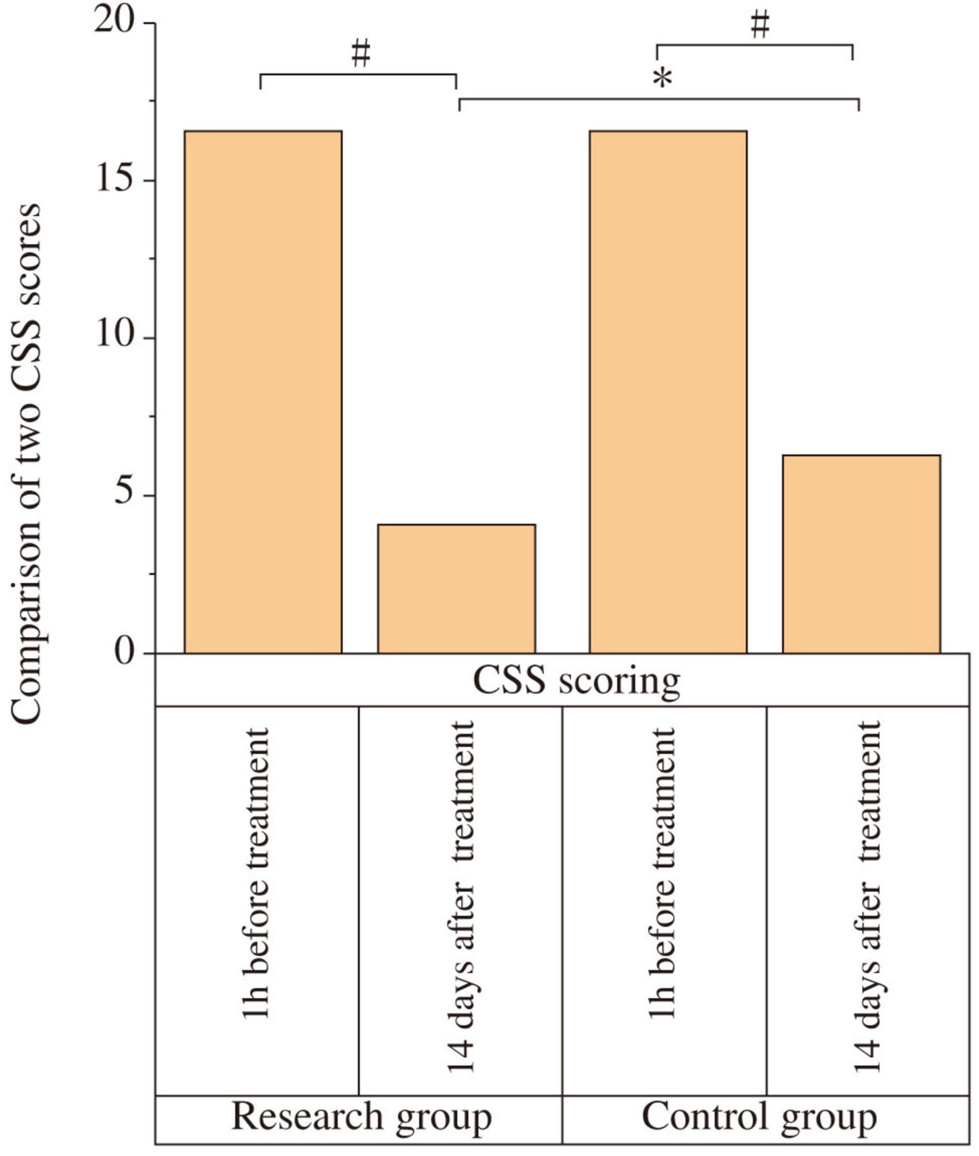 Bar chart comparing CSS scores between research and control groups at different times. Both groups show high scores one hour before treatment. The research group score significantly drops fourteen days after treatment, while the control group shows a smaller decrease. Statistical significance is indicated by symbols for comparisons between and within groups.