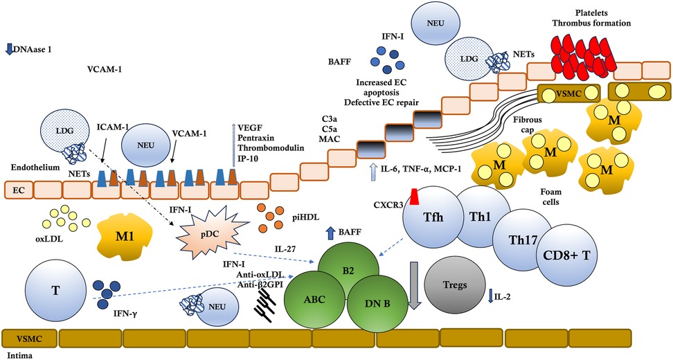 Diagram illustrating immune and inflammatory interactions in the vascular endothelium. It shows the involvement of cells like neutrophils (NEU), low density granulocytes (LDG), macrophages (M), T cells, and platelets. Key proteins and molecules including VCAM-1, ICAM-1, cytokines (IL-6, TNF-a), and markers for apoptosis and thrombus formation are labeled. Signaling pathways and interactions are indicated with arrows, highlighting processes like NET formation, foam cell formation, apoptosis, and inflammation.
