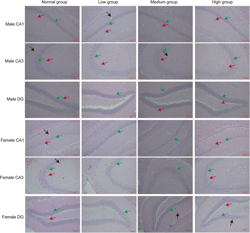 Histological images of brain sections from male and female subjects are shown in groups labeled Normal, Low, Medium, and High. Each row corresponds to a specific brain region (CA1, CA3, DG) for either male or female subjects. Colored arrows indicate specific features in the tissue. Each group's variations are visible, possibly highlighting differences in staining or cell distribution.