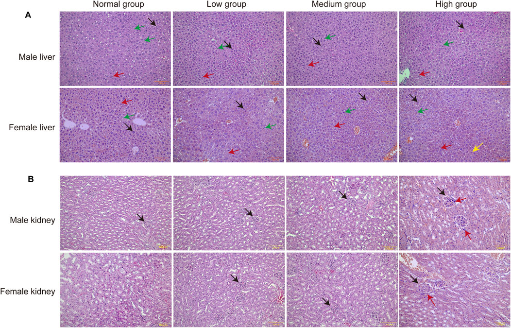 Microscopic images showing the liver and kidney tissues from male and female subjects across four groups: Normal, Low, Medium, and High. Panel A displays liver tissues, with notable differences marked by colored arrows. Panel B shows kidney tissues, also indicating distinctions with arrows. The images highlight variations in cell structure and tissue organization across different treatment or condition groups.