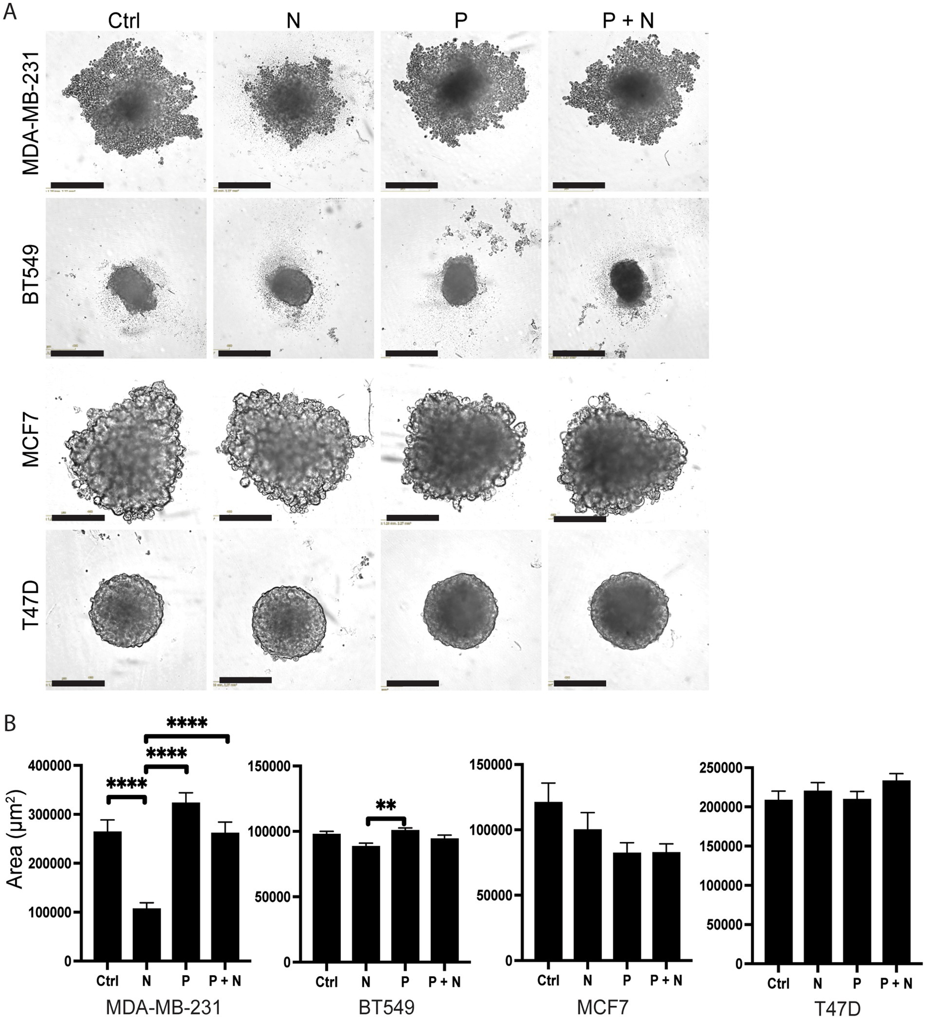 Panel A displays micrographs of four breast cancer cell lines (MDA-MB-231, BT549, MCF7, T47D) under different treatment conditions: Control (Ctrl), N, P, and P + N. The images illustrate variations in cell morphology and clustering. Panel B presents bar graphs comparing the area of cell clusters for each condition in square micrometers. Statistical significance is indicated for MDA-MB-231 and BT549, highlighting differences under treatment conditions.