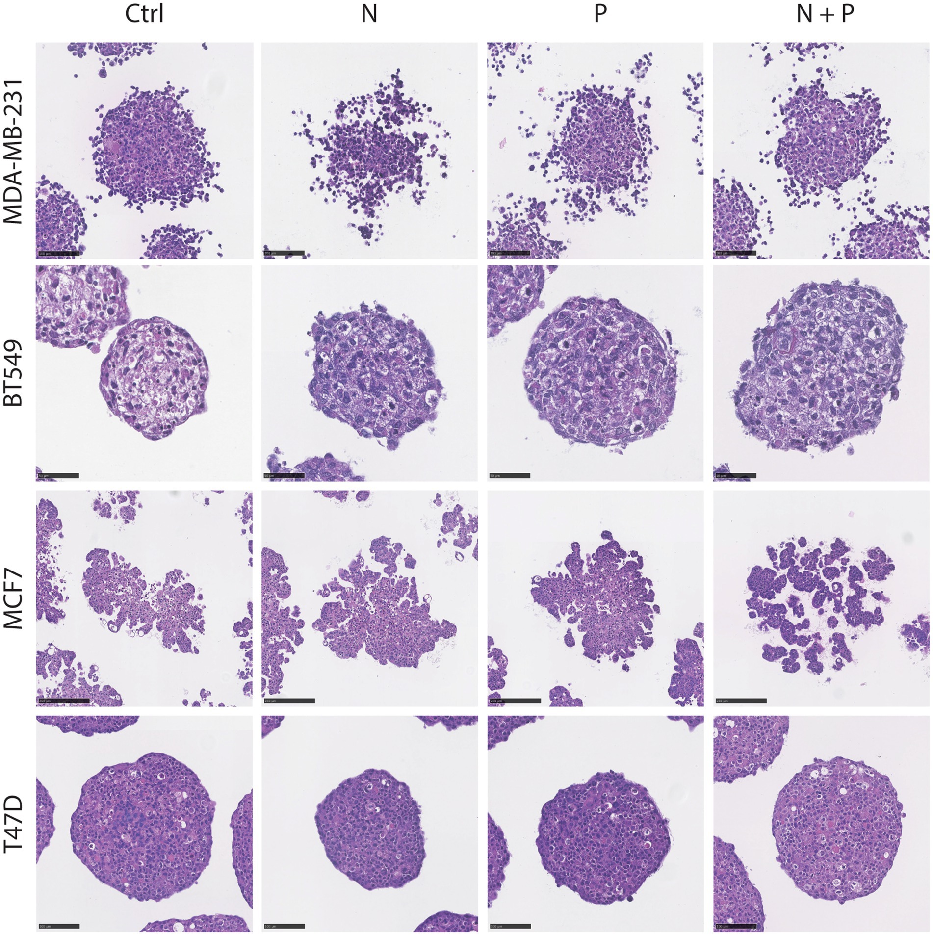 Microscopic images display four types of cell cultures labeled MDA-MB-231, BT549, MCF7, and T47D. Each type is shown under four conditions: Ctrl, N, P, and N+P. The differences in cell morphology and density are evident across the conditions, with cell clusters varying in appearance and compactness.