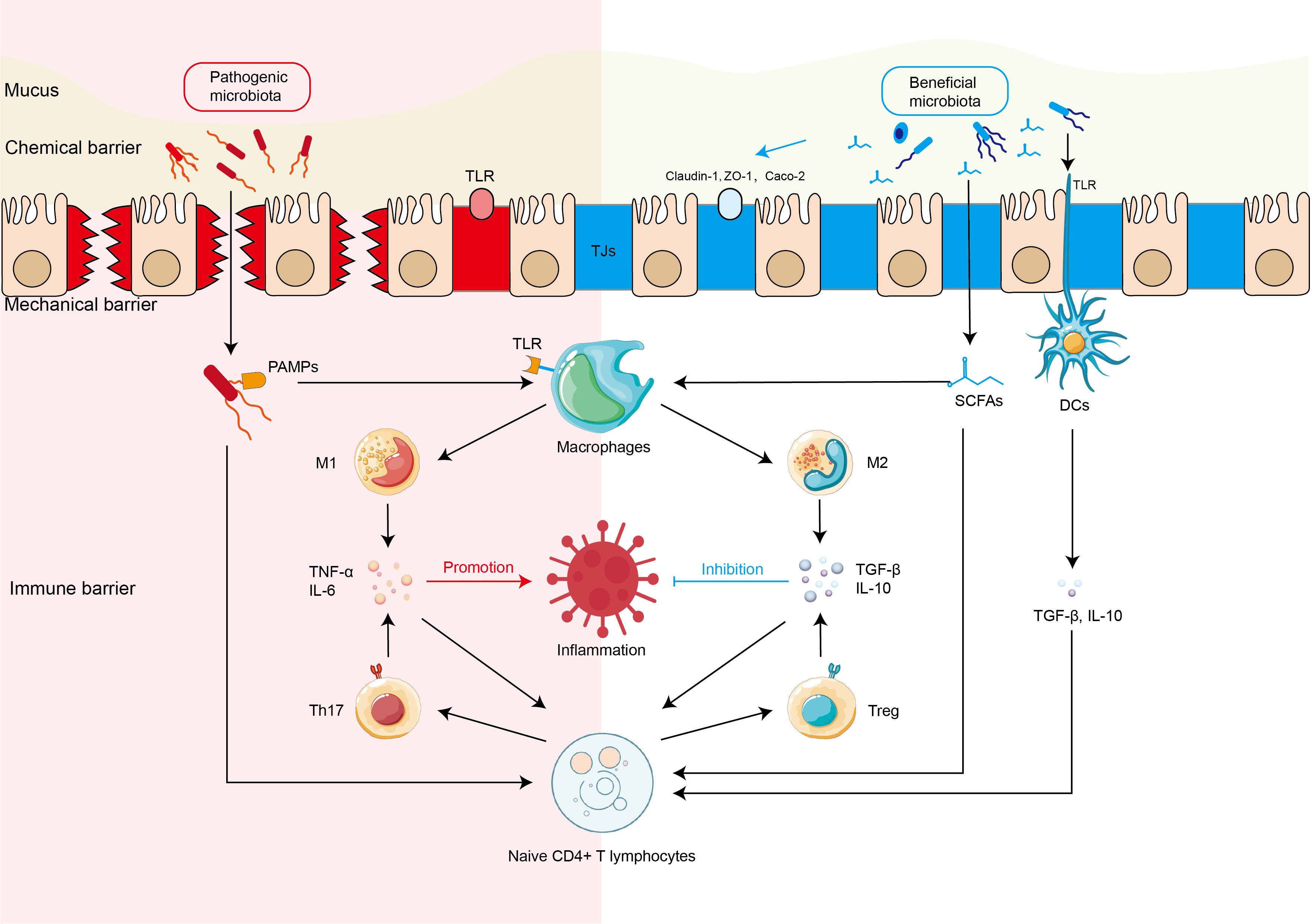Illustration showing intestinal barriers against microbiota. On the left, pathogenic microbiota is depicted affecting the chemical, mechanical, and immune barriers. TLR involvement leads to macrophage activation and inflammation promotion via M1 cells and Th17. On the right, beneficial microbiota maintains barriers, involving SCFAs and dendritic cells with TLRs. M2 cells inhibit inflammation through TGF-β and IL-10, supported by Tregs. Naive CD4+ T lymphocyte development is influenced by both responses.
