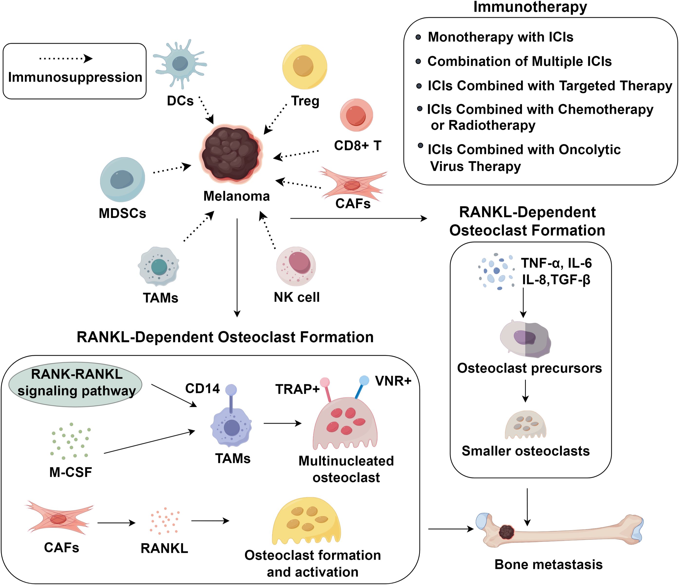 Diagram illustrating the interaction between melanoma and immune cells, leading to RANKL-dependent osteoclast formation and bone metastasis. Top left shows melanoma with dendritic cells, Tregs, CD8+ T cells, MDSCs, and CAFs, indicating immune suppression. Right side notes immunotherapy options like monotherapy with ICIs and combinations. Bottom section details the RANK-RANKL signaling pathway, with M-CSF and TAMs progressing to multinucleated osteoclasts, contributing to osteoclast formation and activation. The process leads to osteoclast precursors forming smaller osteoclasts, resulting in bone metastasis.