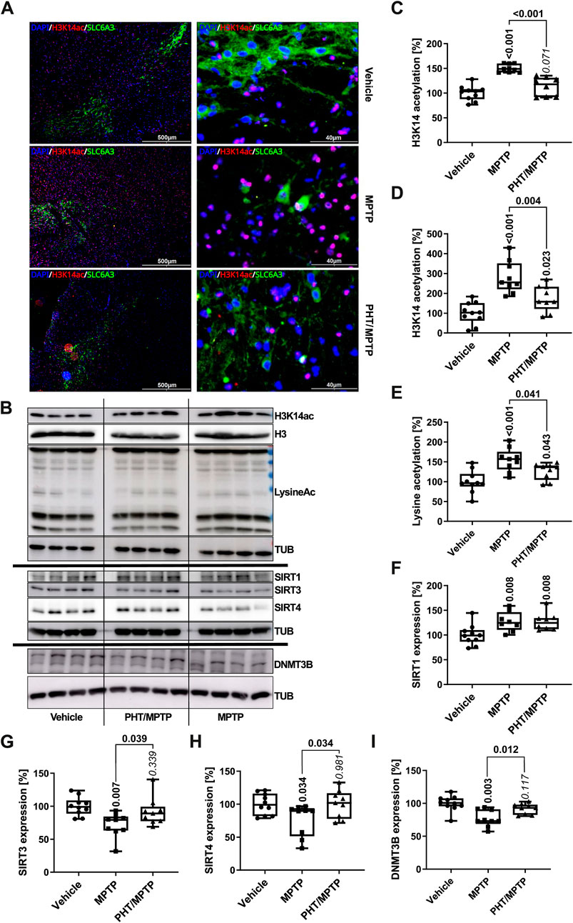 Composite image panel showing in (A) immunofluorescence of brain tissues labeled with DAPI, H3K14ac, and SLC6A3 under different treatments (Vehicle, MPTP, PHT/MPTP). (B) Western blot analysis of proteins including H3K14ac, SIRT1, SIRT3, SIRT4, DNMT3B, and others across treatments. (C-I) Box plots depicting relative protein expression (H3K14ac, lysine acetylation, SIRT1, SIRT3, SIRT4, DNMT3B) in the Vehicle, MPTP, and PHT/MPTP groups with accompanying p-values indicating statistical significance.