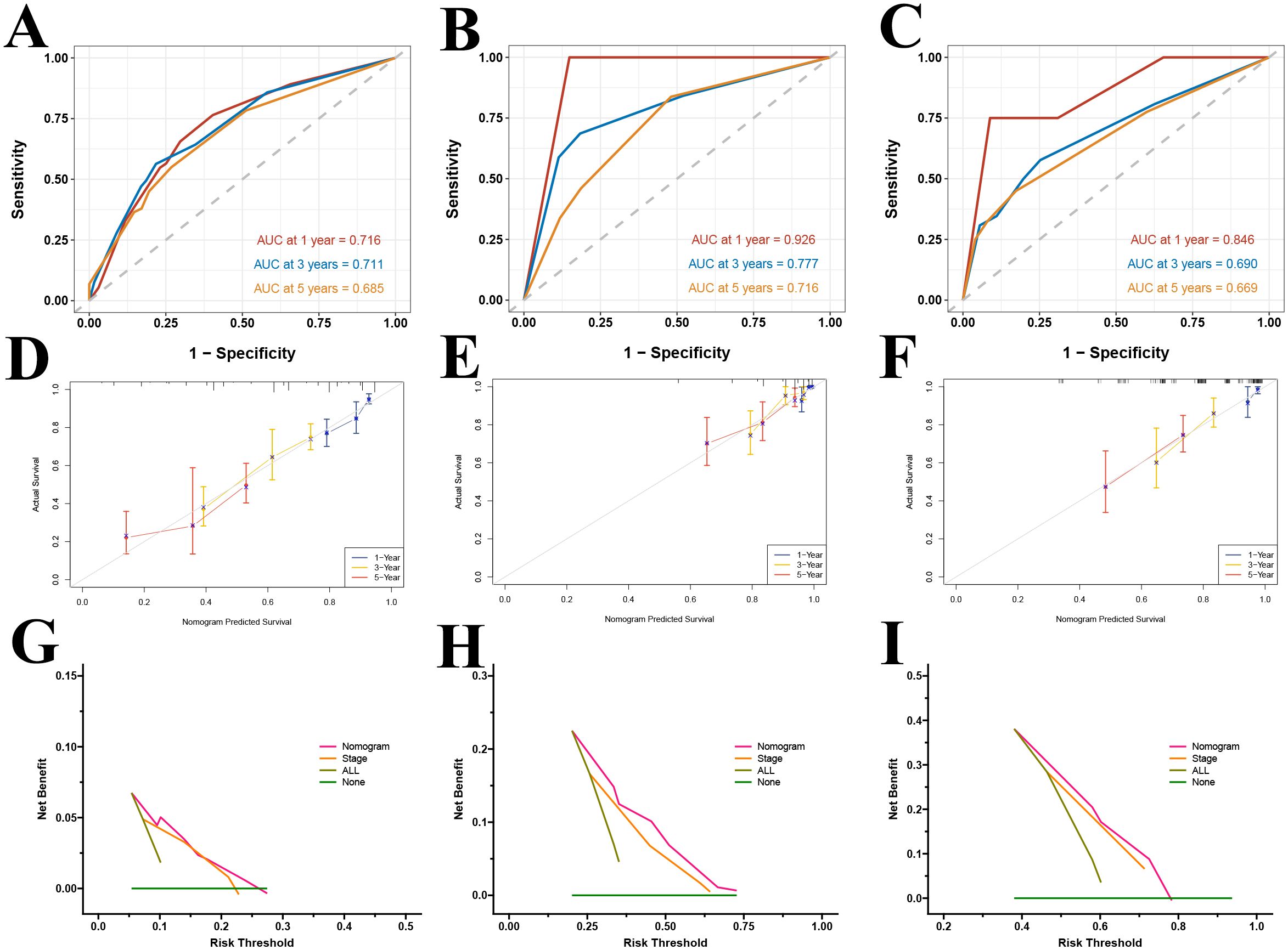 Graph panels A-C illustrate ROC curves with different AUC values for one, three, and five-year survival predictions across three models. Panels D-F show calibration plots comparing actual versus nomogram-predicted survival for the same timeframes. Panels G-I present decision curve analyses indicating net benefit across varying risk thresholds, comparing nomogram, stage, all, and none strategies.