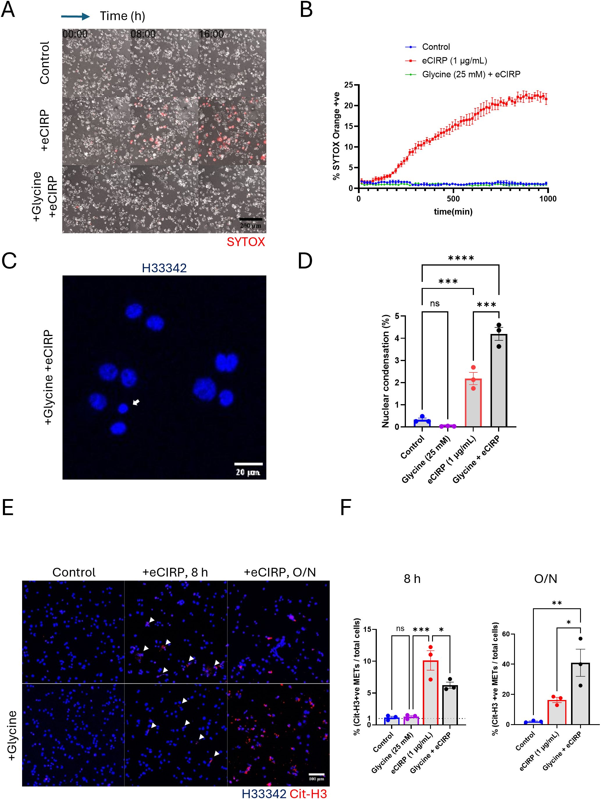 Panel of images and graphs illustrating cell response to treatments. (A) Microscopy images showing cells under control, eCIRP, and glycine plus eCIRP conditions at intervals, with SYTOX marking dead cells in red. (B) Line graph displaying the percentage of SYTOX-positive cells over time for different conditions. (C) Fluorescent image of nuclei stained with H33342, highlighting nuclear condensation. (D) Bar graph quantifying nuclear condensation under various treatments, with significance indicated by asterisks. (E) Fluorescent images showing DNA (blue, H33342) and citrullinated histone H3 (red), with different treatments over time. (F) Bar charts showing the percentage of MET-positive cells under different conditions, with statistical significance noted by asterisks.