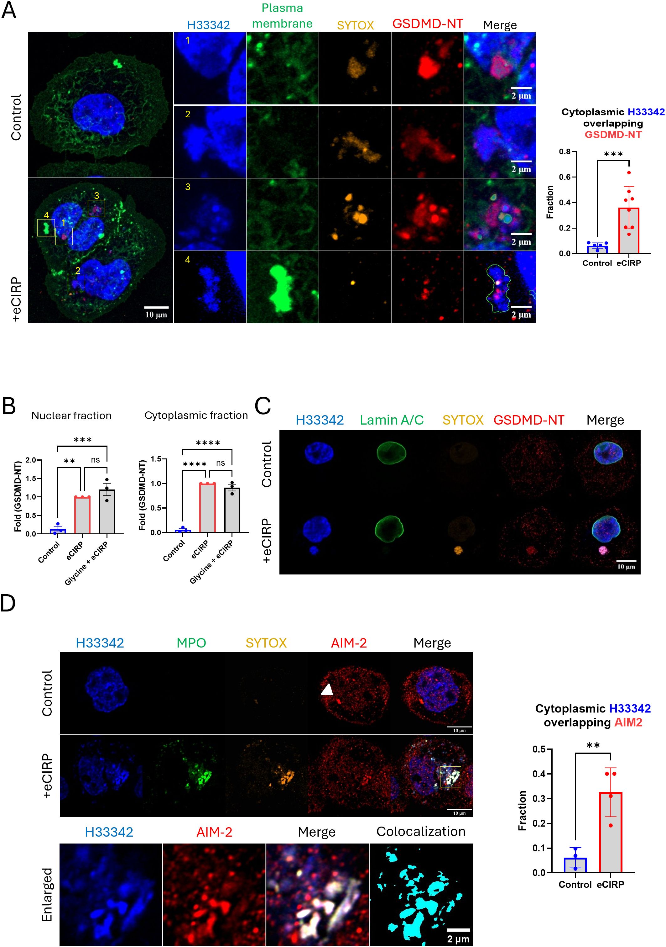 Panel A shows fluorescent images of cells labeled with H33342, plasma membrane marker, SYTOX, and GSDMD-NT, comparing control and eCIRP-treated groups. A bar graph illustrates the fraction of cytoplasmic H33342 overlapping with GSDMD-NT, with higher fraction in eCIRP-treated group. Panel B presents bar graphs of nuclear and cytoplasmic GSDMD-NT expression, showing significant differences between treatments. Panel C displays fluorescent images labeled with H33342, Lamin A/C, SYTOX, and GSDMD-NT, showing control and eCIRP-treated comparisons. Panel D contains fluorescent images labeled with H33342, MPO, SYTOX, and AIM-2, alongside an enlargement and a colocalization analysis graph, emphasizing changes in AIM-2 localization in eCIRP-treated cells.