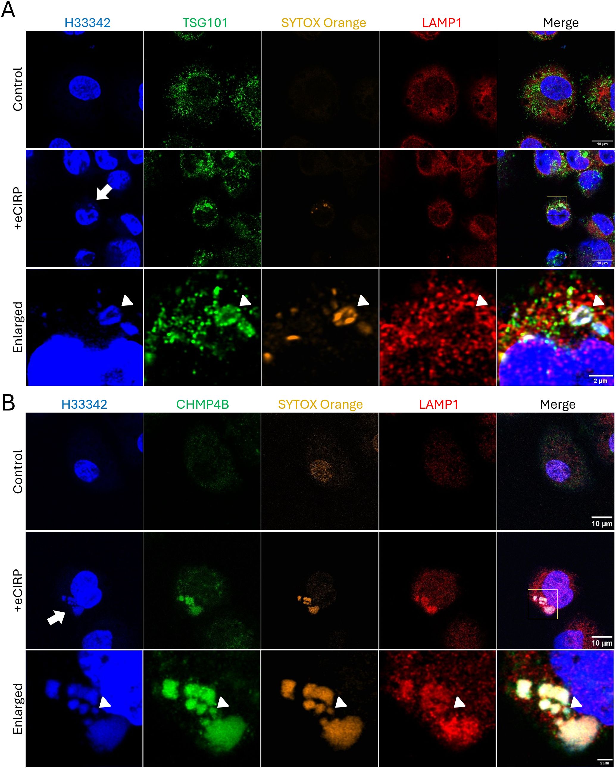 Fluorescence microscopy images show cellular components under different conditions. Panel A shows segments dyed with H33342 (blue), TSG101 (green), SYTOX Orange (orange), and LAMP1 (red). Images are provided for control, +ecLRP treatment, and an enlarged view. Panel B follows a similar format but labels CHMP4B instead of TSG101. Merged images reveal cellular interactions. Each panel compares control and treated cells, highlighting specific markers with arrows and arrowheads. Scale bars are included.