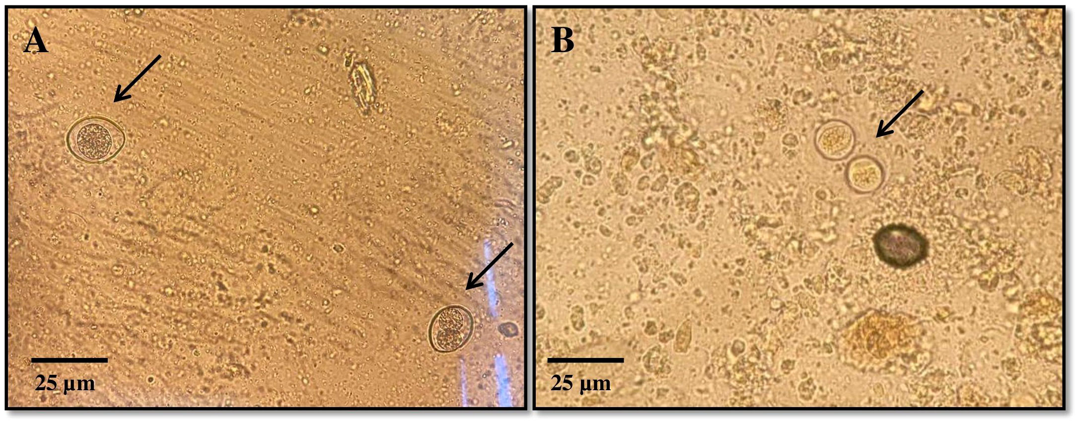 Microscopic images labeled A and B show round structures with dark centers on a light brown background. Arrows point to specific structures. A scale bar indicates a size of twenty-five micrometers.