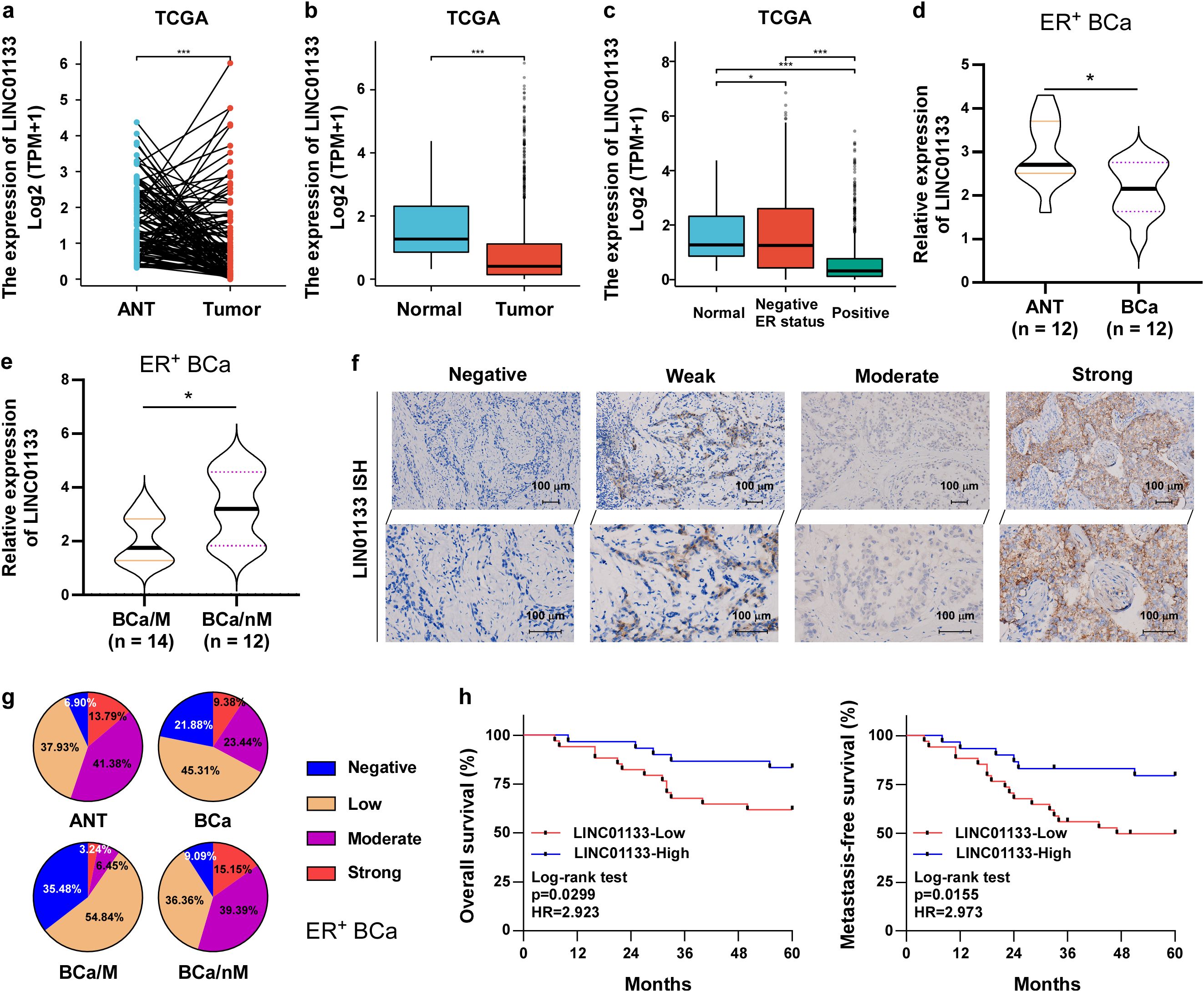 Graphs, charts, and images analyze LINC01133 expression in tumors. Bar charts (a-d) show higher expression in tumor tissues. Violin plots (e) indicate expression differences in estrogen receptor-positive breast cancer. Histological images (f) display varying expression levels. Pie charts (g) compare expression intensity in different samples. Kaplan-Meier plots (h) illustrate survival data, indicating lower overall and metastasis-free survival linked to high LINC01133 expression.